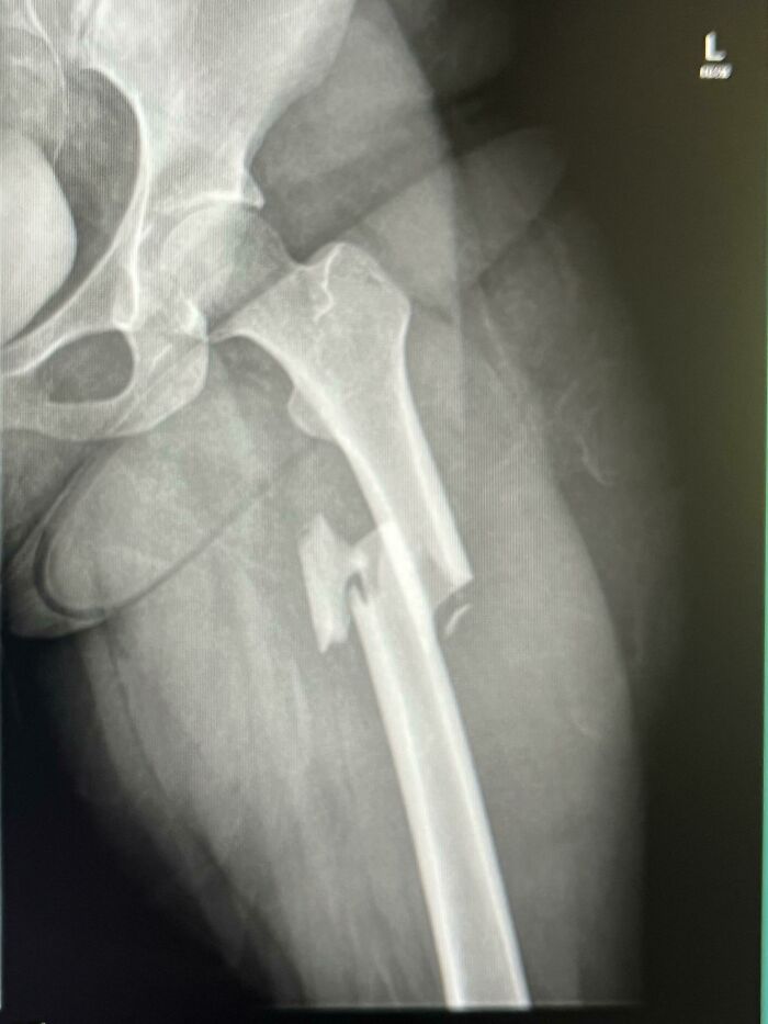 Free Fall From 30 Ft