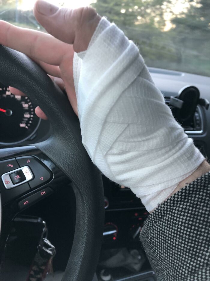 Day 3 Of Starting My New Job, I Managed To Slice My Hand Open With A Box Cutter Somehow