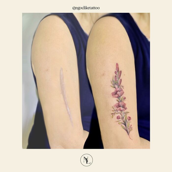 50 Times People Asked To Cover Up Their Scars, And This Tattoo Artist Nailed It (New Pics)