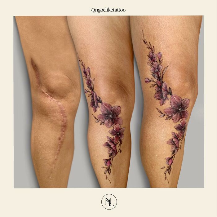 50 Times People Asked To Cover Up Their Scars, And This Tattoo Artist Nailed It (New Pics)