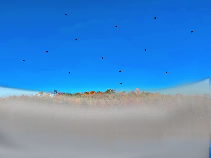 My Retina Detached And This Is What It Looked Like "Through My Eyes"