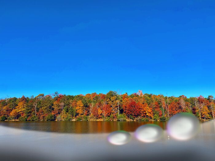 My Retina Detached And This Is What It Looked Like "Through My Eyes"