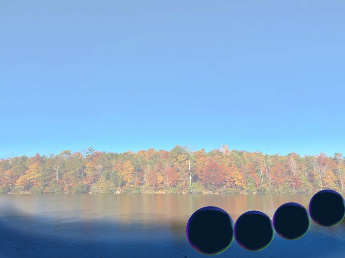 My Retina Detached And This Is What It Looked Like "Through My Eyes"