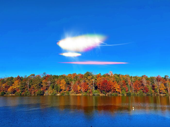 My Retina Detached And This Is What It Looked Like "Through My Eyes"