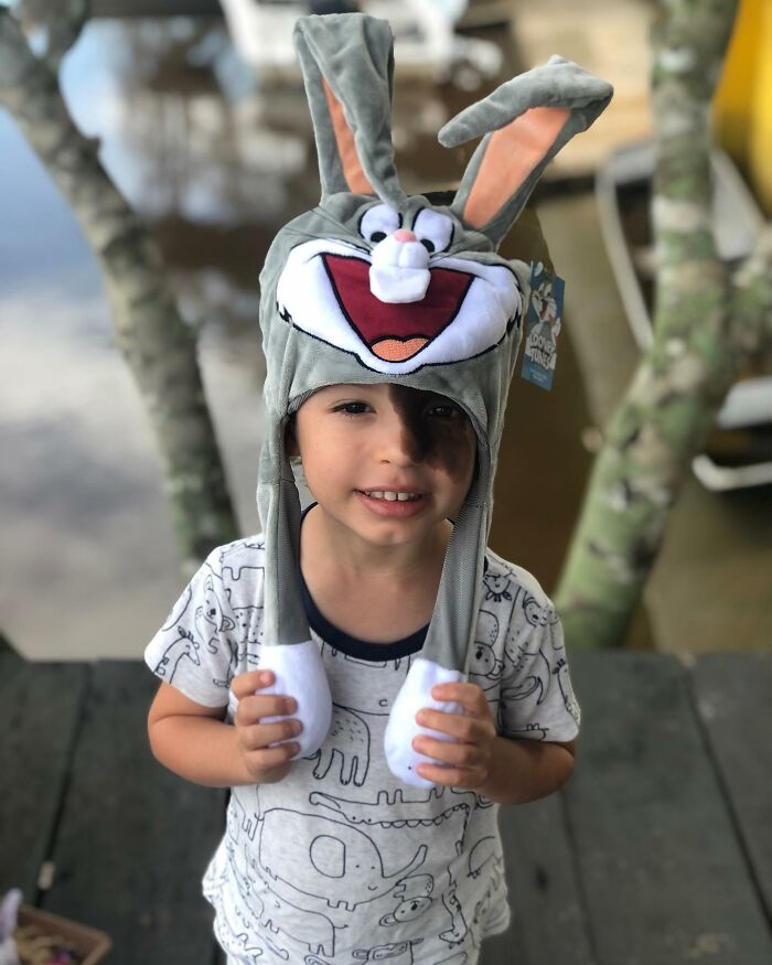 Societal Judgement Towards Enzo's Mark On His Face Encouraged His Mom To Replicate It On Hers To Walk In His Shoes