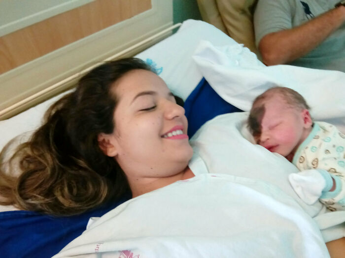 Societal Judgement Towards Enzo's Mark On His Face Encouraged His Mom To Replicate It On Hers To Walk In His Shoes