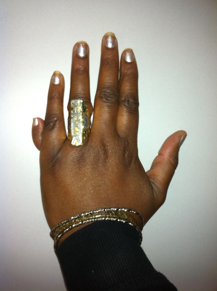 25 Personas que vivieron situaciones "únicas entre un millón" comparten sus fascinantes historias