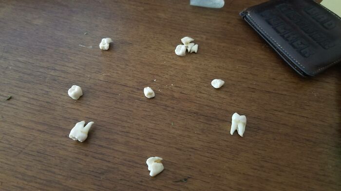 25 Personas que vivieron situaciones "únicas entre un millón" comparten sus fascinantes historias