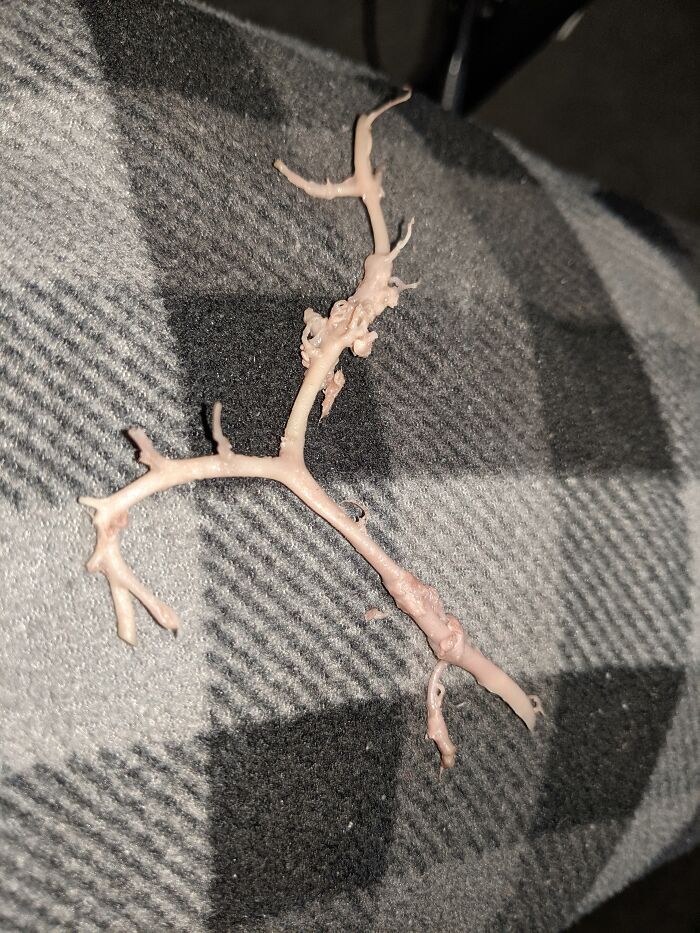 Found This Is A Piece Of Beef I Was Eating. Felt Like A Rubber Band