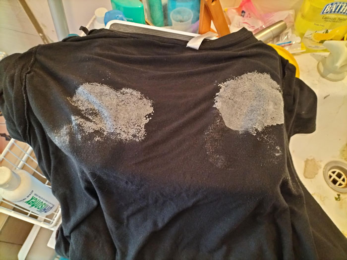 4 Days Into Sunburn Recovery, My T-Shirt Got Stuck To My Back And