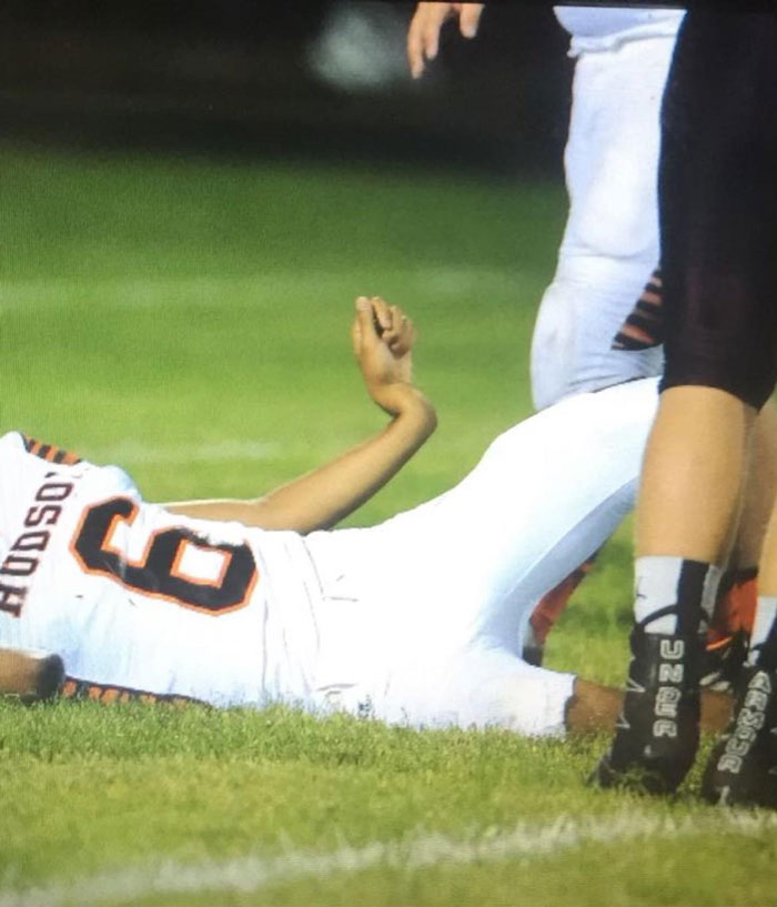 My Buddy Broke His Arm A Few Years Ago