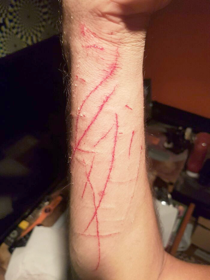 Just Because His Brother (That He Hates) Jumped Up On The Bed. So He Took It Out On Me. Also, Bit My Hand