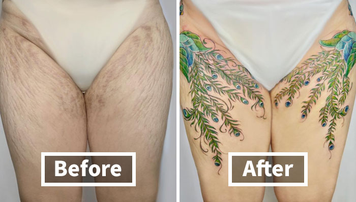 50 Times People Asked To Cover Up Their Scars, And This Tattoo Artist Nailed It (New Pics)