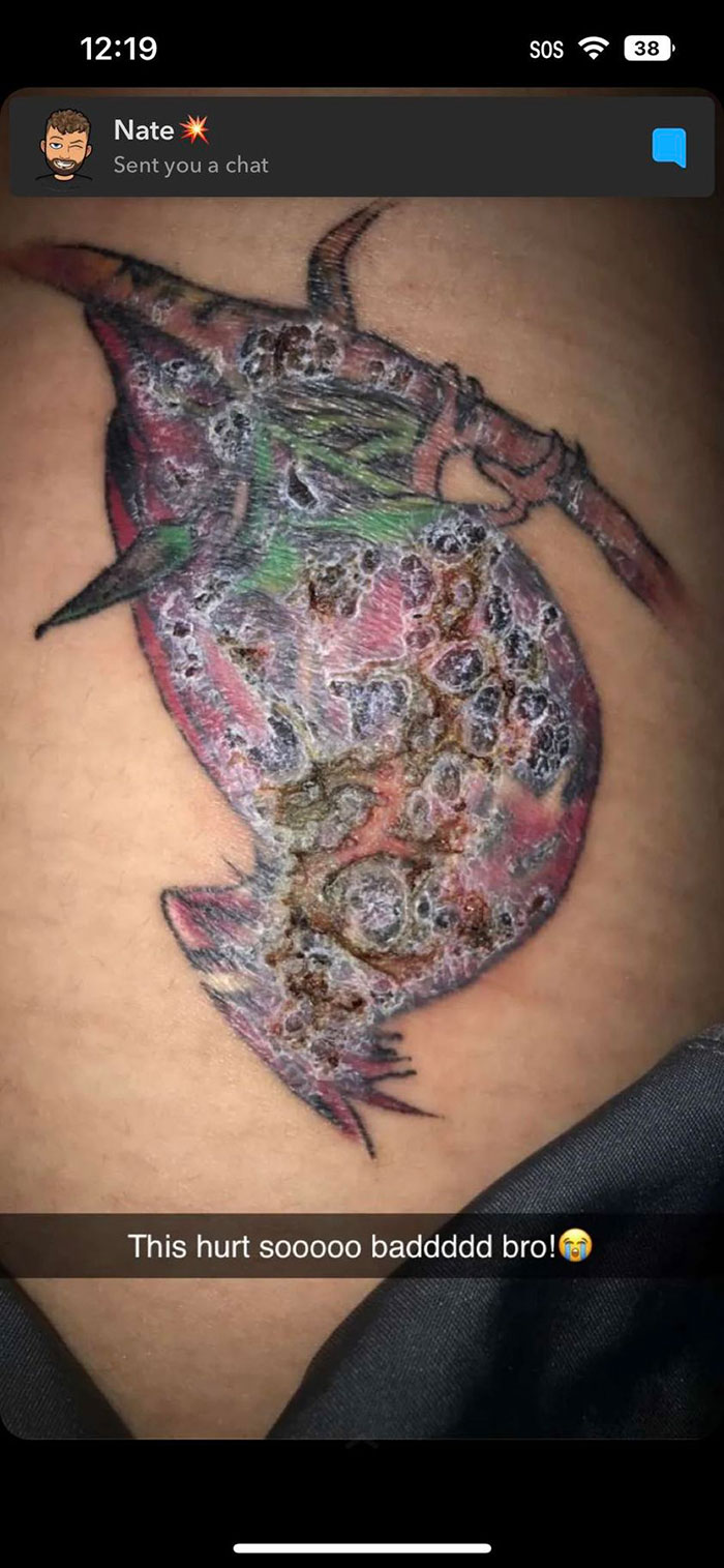 Bad tattoo with bumpy scars, showing an awkward design on skin shared in a chat.