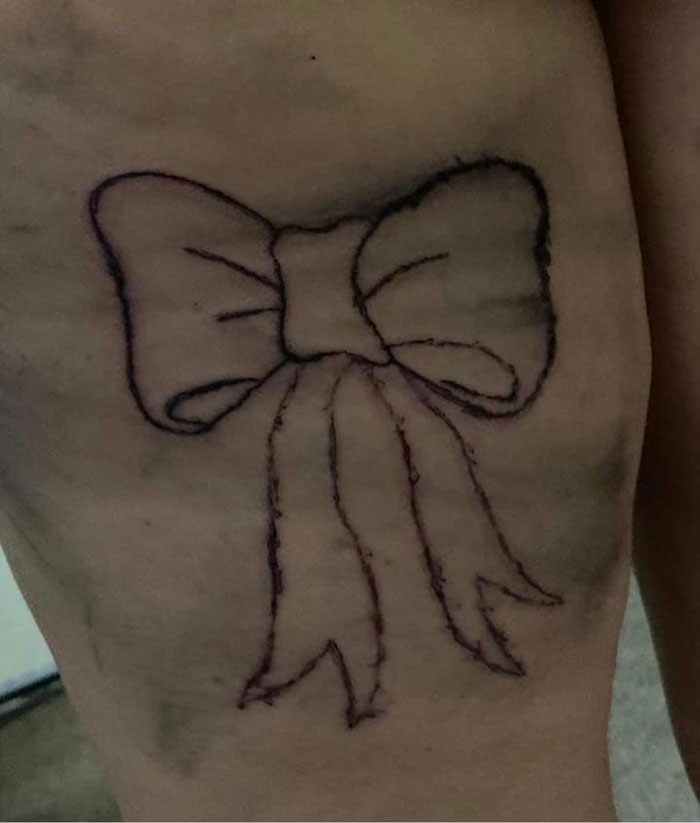 Poorly drawn bow tattoo on skin, shared by a Facebook group highlighting bad tattoos.