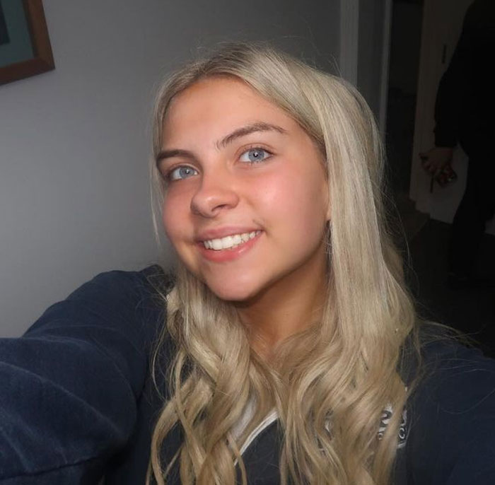 Woman's Face Starts Flaring Up Right Before Work, So She Films What It Looks Like To Raise Awareness