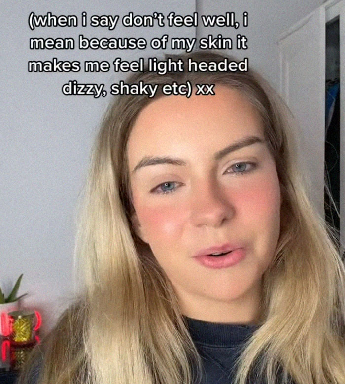 Woman's Face Starts Flaring Up Right Before Work, So She Films What It Looks Like To Raise Awareness