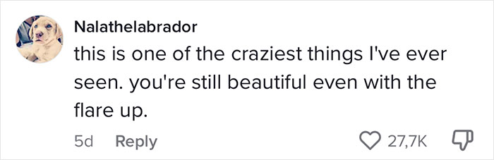 Woman's Face Starts Flaring Up Right Before Work, So She Films What It Looks Like To Raise Awareness