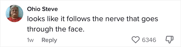 Woman's Face Starts Flaring Up Right Before Work, So She Films What It Looks Like To Raise Awareness
