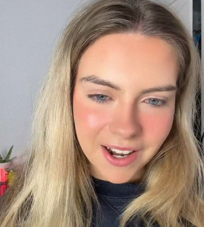 Woman's Face Starts Flaring Up Right Before Work, So She Films What It Looks Like To Raise Awareness