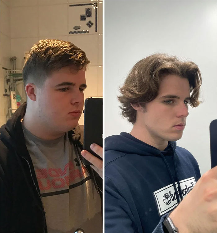 Face Change After Loosing Weight