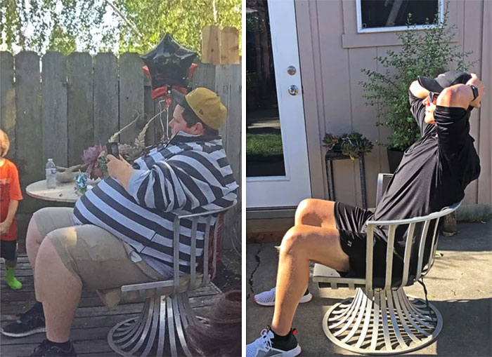 Same Chair. 3 Years Later. Hoping For Skin Surgery Soon