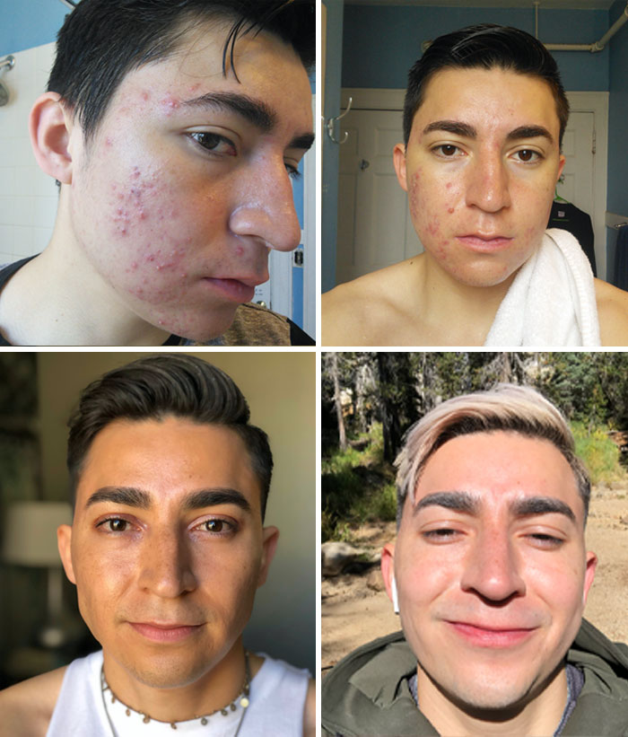 A Few Years Passed Before I Finally Felt Confident Enough To Post My Own Progress