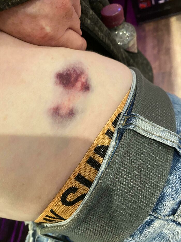 My Friend Went Into A Fugue State And Wandered Into The Countryside At 3am