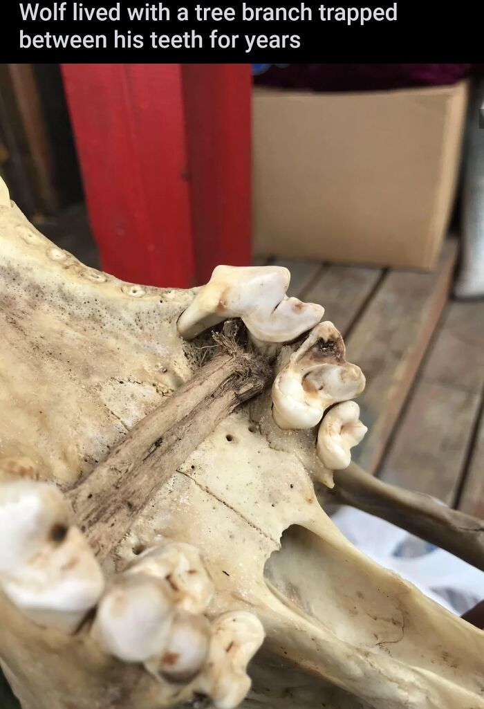 And You Think Having A Popcorn Kernel Stuck Is Bad