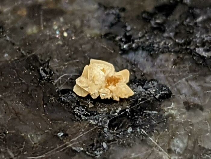 Kidney Stone I Just Passed