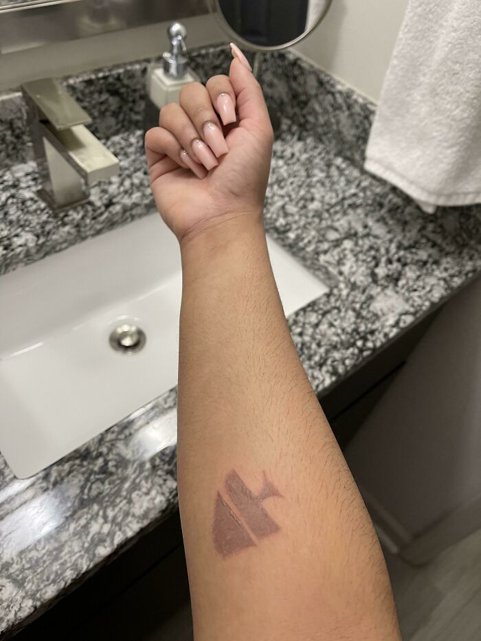 I Accidentally Burned My Arm And It Looks Like A Tree. Merry Christmas I Guess