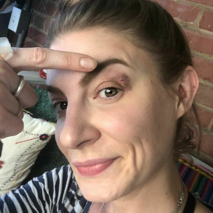 That Was Close. Apparently, I’m Just Going To Wear Safety Glasses Every Moment I’m Working On Anything Renovation Related