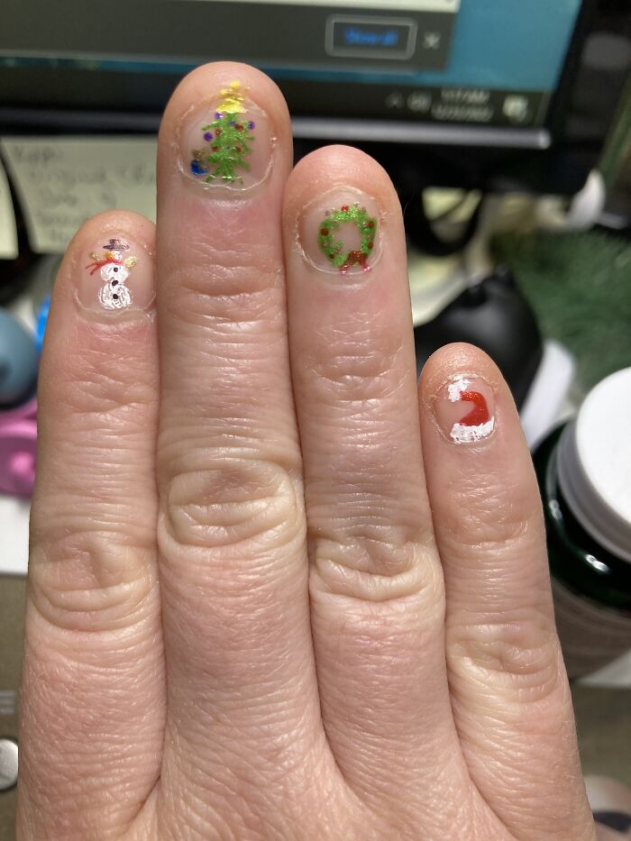 I Am A Chronic, Lifelong Nail-Biter (Due To Tons Of Unresolved Trauma & Stress). I Felt Sad About Having No Nails To Paint, So I Drew On Some Holiday Nail Art Myself With Glitter Pens :)