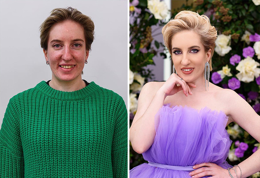 TV Show Gives People An Extreme Makeover, Here Are 52 Of The Best Before-And-After Pics TV Show Gives People An Extreme Makeover, Here Are 52 Of The Best Before-And-After Pics