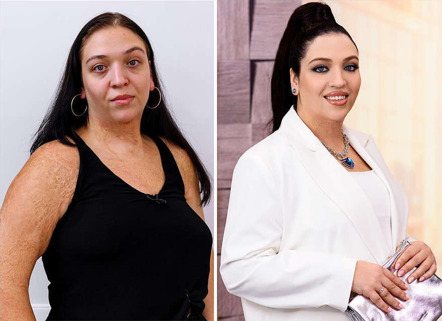 TV Show Gives People An Extreme Makeover, Here Are 52 Of The Best Before-And-After Pics TV Show Gives People An Extreme Makeover, Here Are 52 Of The Best Before-And-After Pics