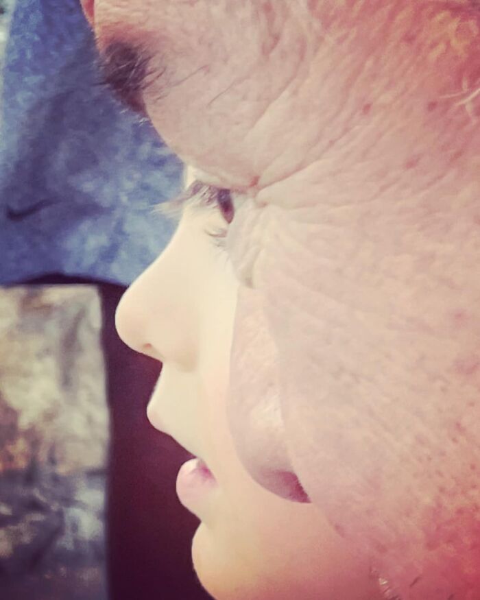 Accidental-Surrealism