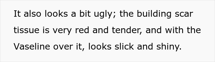 "Am I The Jerk For Leaving Significant Facial Scarring Uncovered On A Plane And Being Confrontational When Asked To Cover It?"