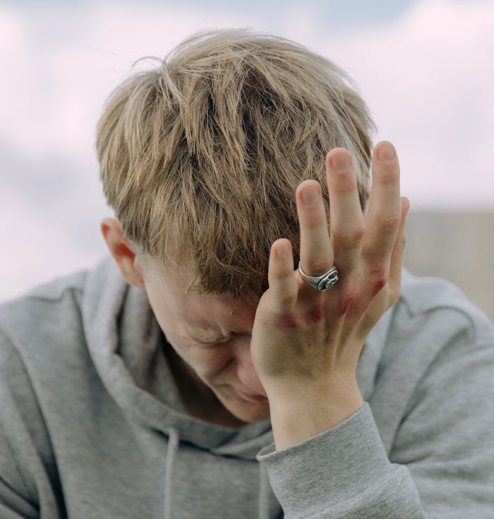Young man with bruised hand in gray hoodie showing distress, illustrating importance of doctors and second opinion stories.