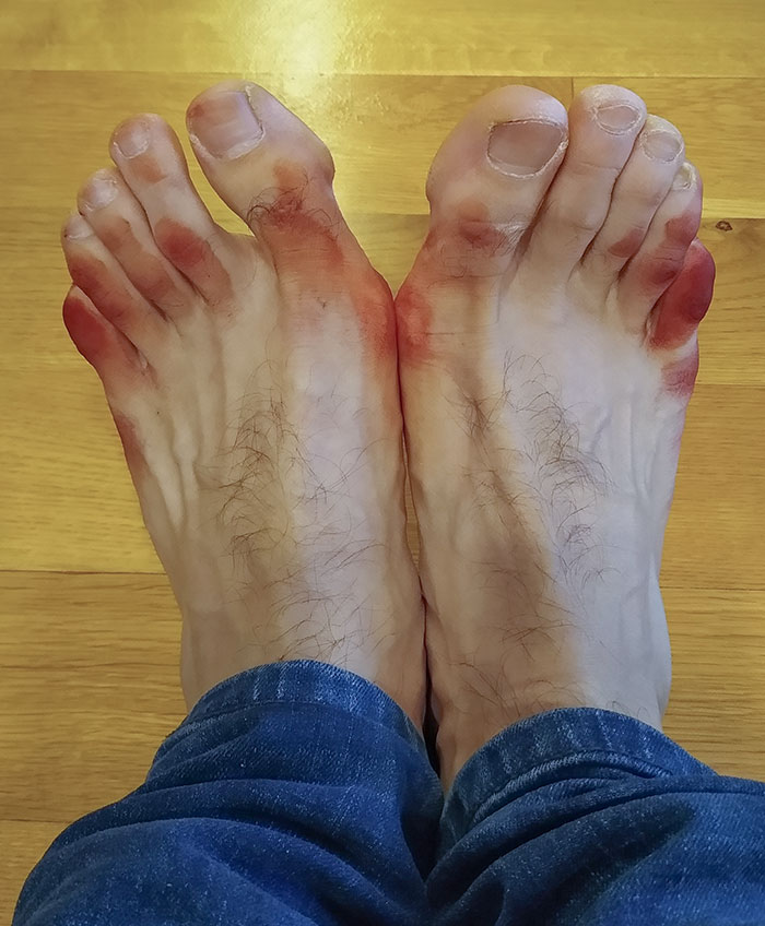 Decided To Wear My New, Red Christmas Socks Today. Apparently, Santa's Red Discharge Can't Just Be Washed Off With Some Water And Soap