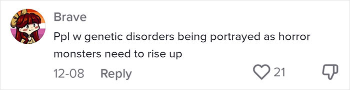 &ldquo;Are We Really That Scary To Y&rsquo;all?&rdquo;: Person With Marfan Syndrome Goes Viral With 1M Views For Calling Out Horror Writers&rsquo; Choice In Monster Design