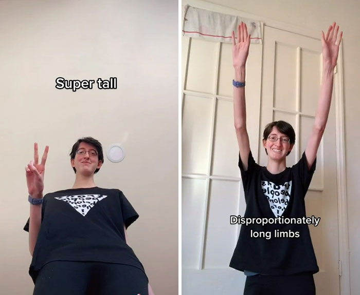 &ldquo;Are We Really That Scary To Y&rsquo;all?&rdquo;: Person With Marfan Syndrome Goes Viral With 1M Views For Calling Out Horror Writers&rsquo; Choice In Monster Design