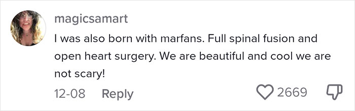 &ldquo;Are We Really That Scary To Y&rsquo;all?&rdquo;: Person With Marfan Syndrome Goes Viral With 1M Views For Calling Out Horror Writers&rsquo; Choice In Monster Design