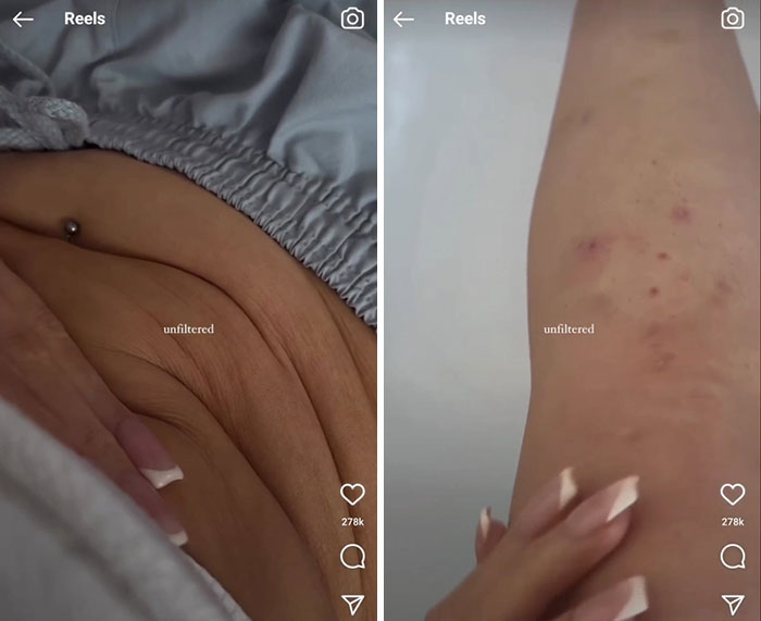 So Glad People Who Show It Like It Is Exist