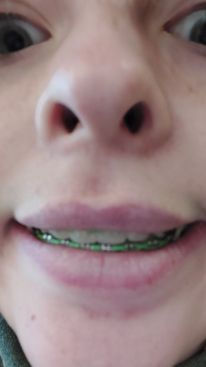 I Don't Typically Let My Friend Take Selfies On My Phone. This Is Usually What I Get When I Do