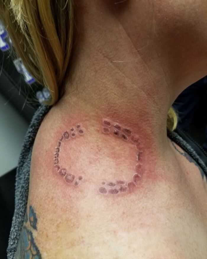 Poorly designed tattoo of a circle with dots on a person's neck, showing quality ink but flawed artistry.