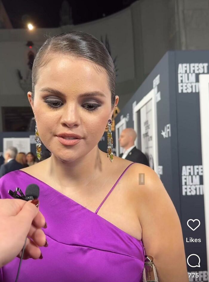 Skin Texture Is Normal And Human. This Is Refreshing