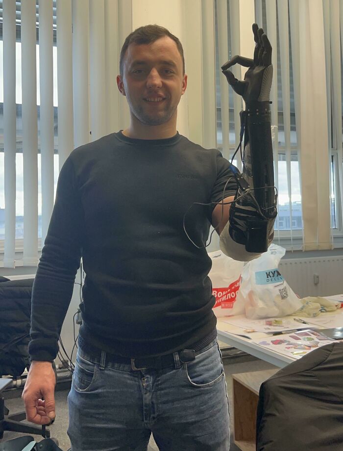 Last Weekend We Began Delivering 3D Printed Bionic Hands To Ukraine! First Up, A 24 Year Old Soldier
