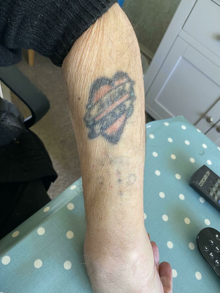 Aged heart tattoo on forearm, showing faded ink and changes over the years against polka dot tablecloth background.