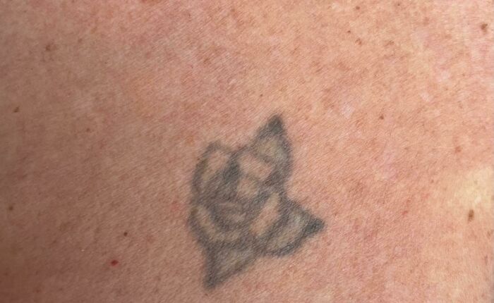 Aged tattoo showing faded ink on skin over the years.