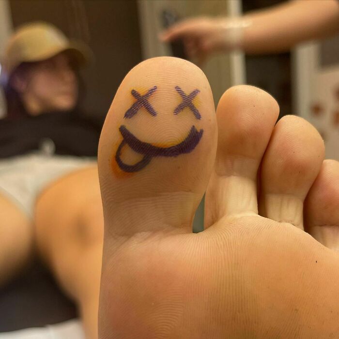 Funny smiley face tattoo on a toe with crossed-out eyes and a tongue sticking out.